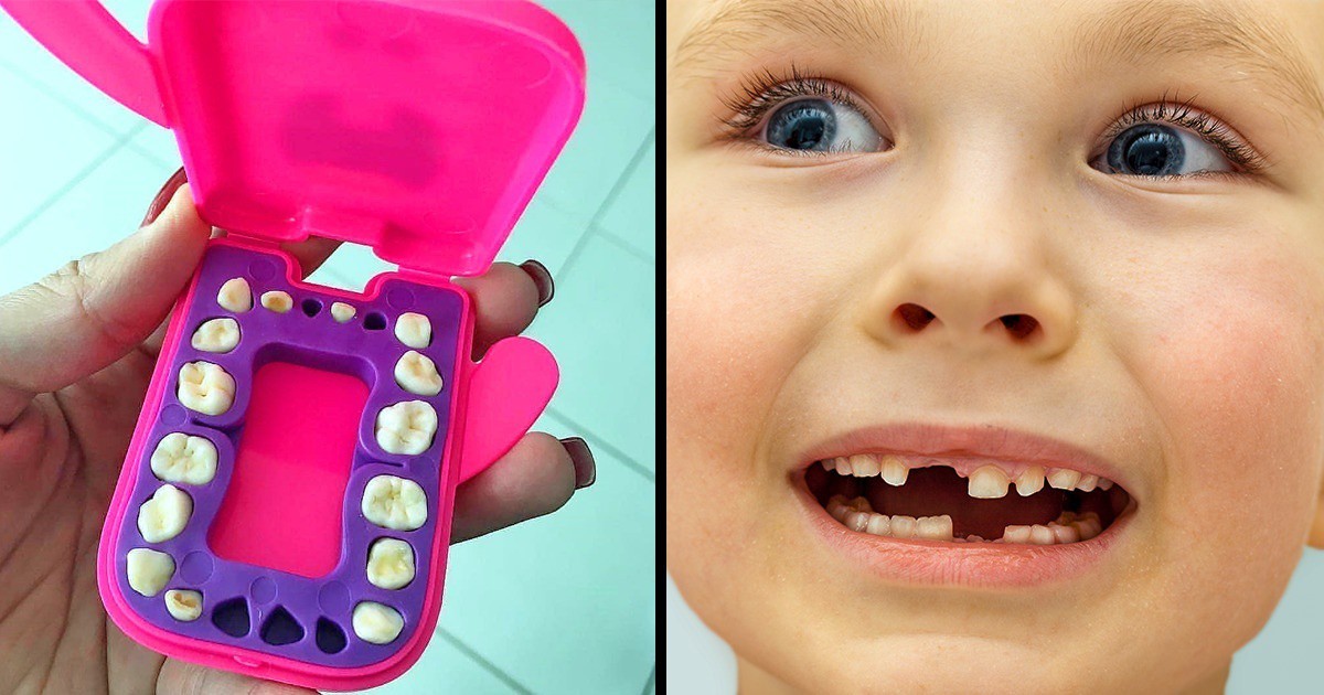 Ето защо зъболекарите препоръчват да пазите млечните зъби на детето
