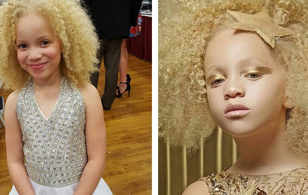 Ава Кларк: 8-годишното момиченце албинос, което покори света на модата