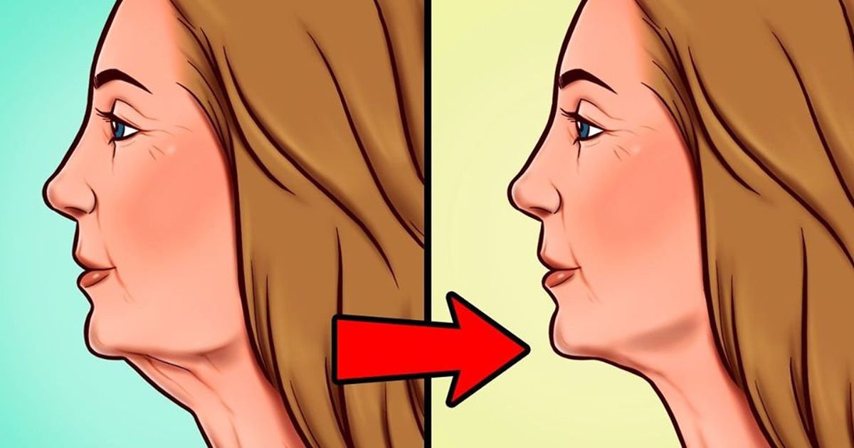 7 начина да се отървете от двойната гуша по естествен път
