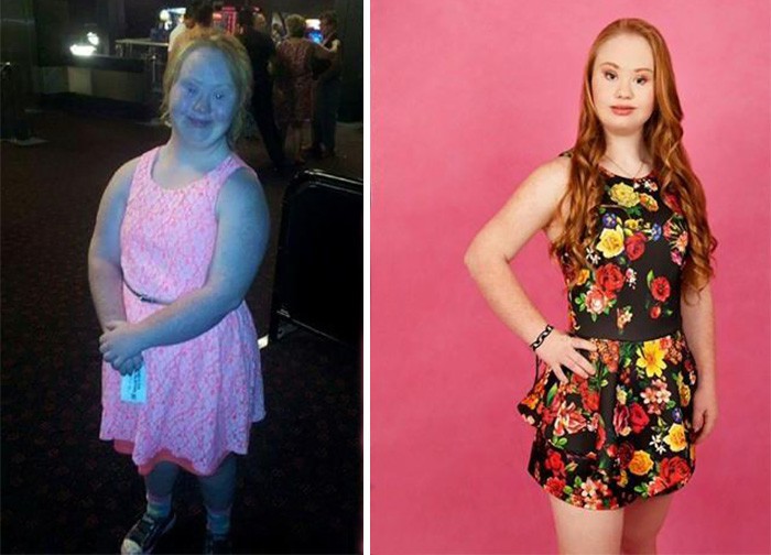 Вдъхновяващата история на младо момиче със синдрома на Даун, което иска да бъде модел