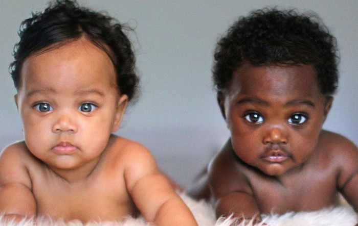 Запознайте се с близначките с различен цвят на кожата