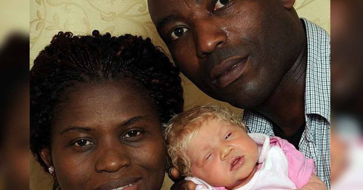 Невероятно: Роди се синеоко бебе на двама чернокожи родители