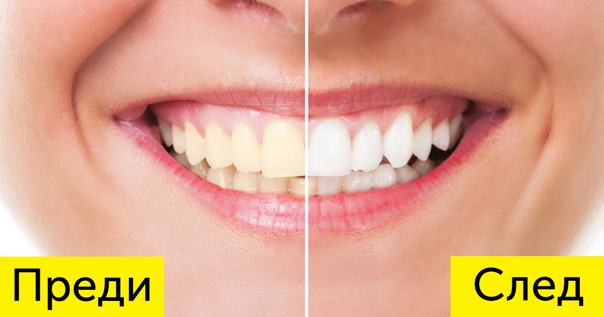 8 естествени начина за избелване на зъбите в домашни условия