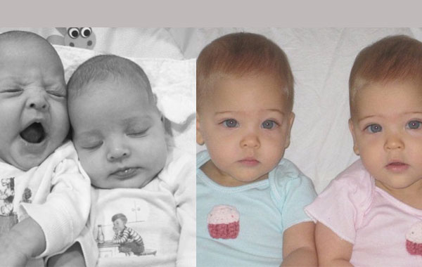 Те са родени през 2010 година и днес вече са определяни за най-красивите близначки на света