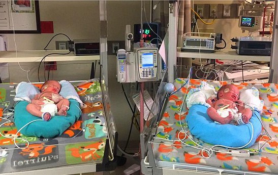 Цели четири двойки близнаци се родиха в различни години!