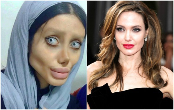 Момиче си направи над 50 операции, за да прилича на Анджелина Джоли