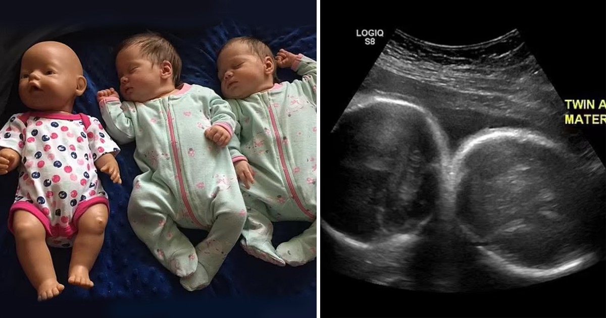 Истинско чудо: Майка забременя ДВА пъти с 8 дни разлика и роди близначки