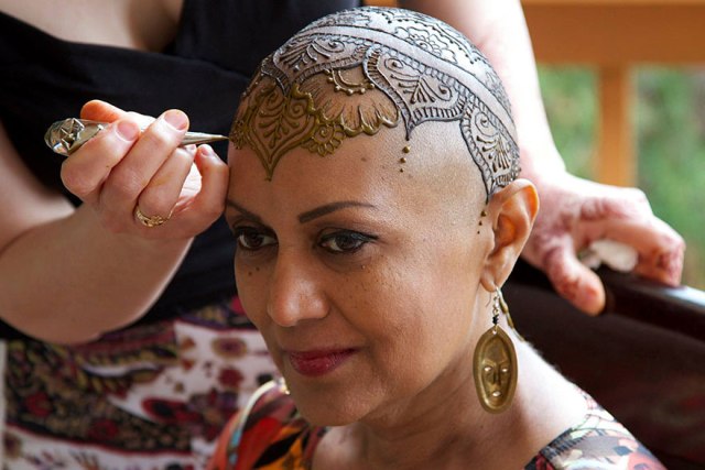 Татуировки корони помагат на болни от рак да живеят пълноценно