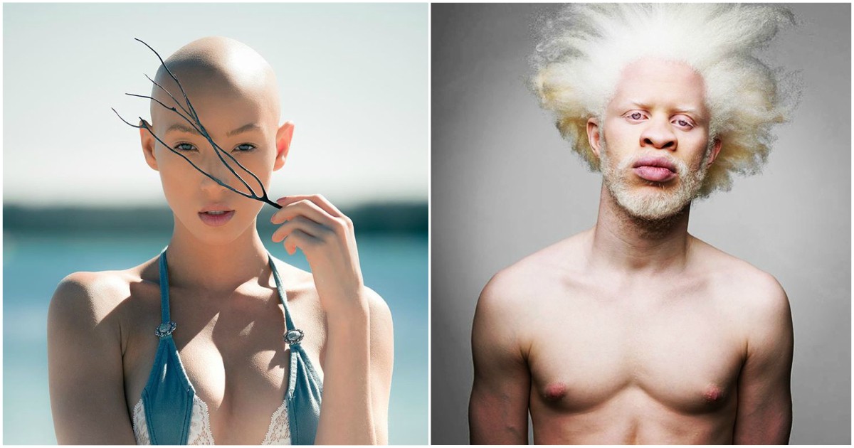 13 модели с нетипична красота, които вдъхновяват милиони хора по света